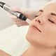 Curso de Microneedling 5 mini mc