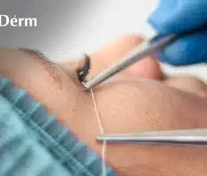 Fiber Hilos