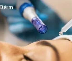 Microneedling + BBGlow + BBLips