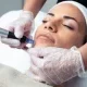 Curso de Microneedling 4 microneedling 1 e1701094917595