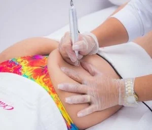 curso de micropuntura brasileña