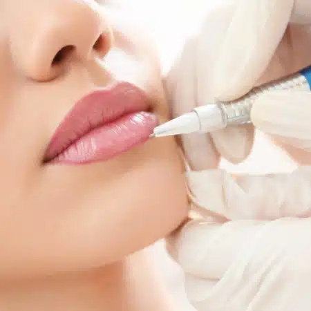Inicio 22 BB lips
