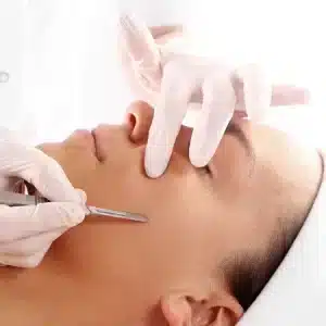 Dermaplaning