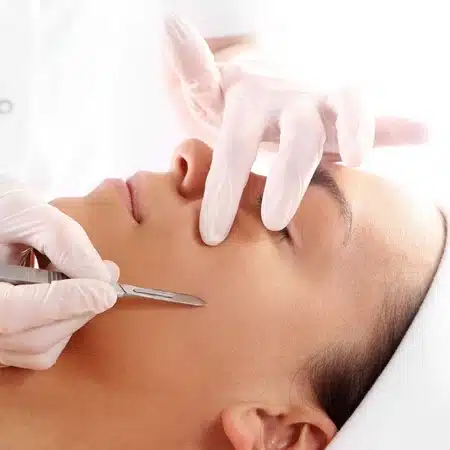 Inicio 11 Dermaplaning
