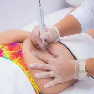 Micropuntura Brasileña