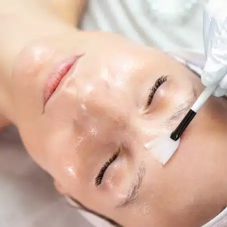 Inicio 6 Peeling facial