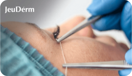 Cursos 15 fiberhilos